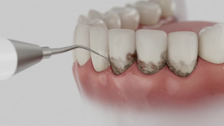 Trusted Root Canal Treatment service in Clayton, DE - Dentist Open Now